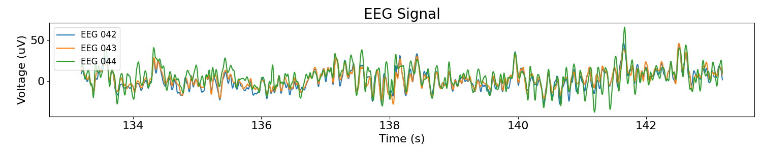 EEG Signal
